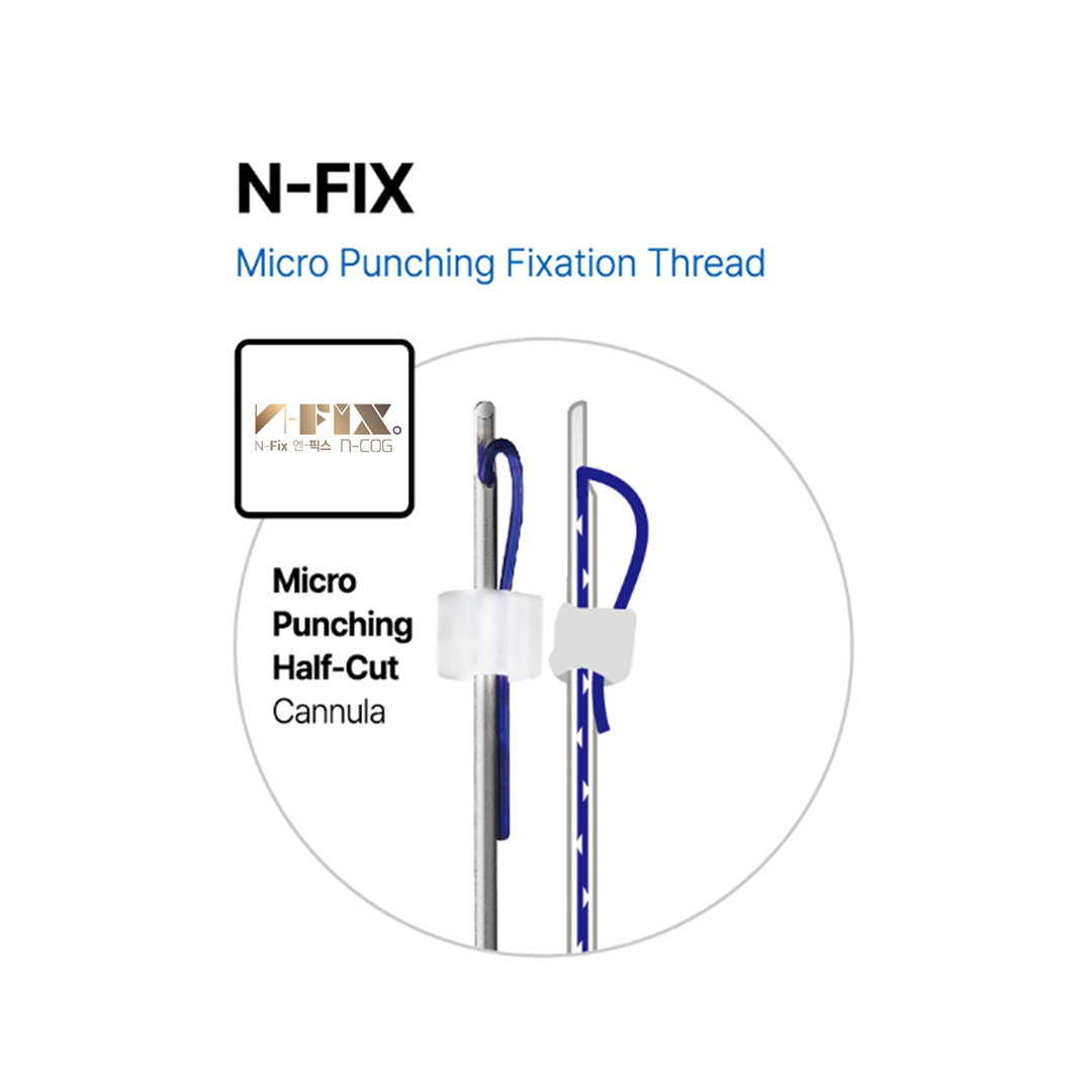 🎁 N FIX19G 100MM (100% off)