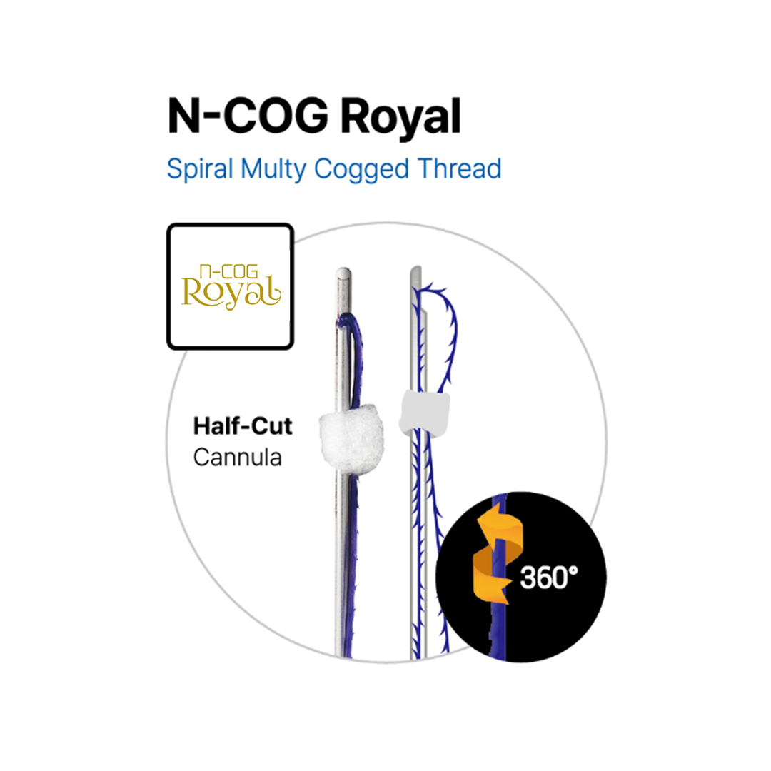 🎁 ROYAL THREADS 100 M (100% off)
